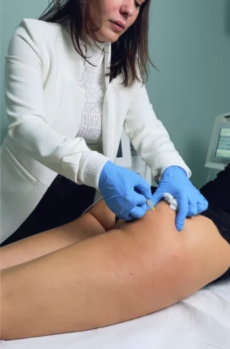 Carbossiterapia gambe e glutei eseguita presso Monti Parioli Medical