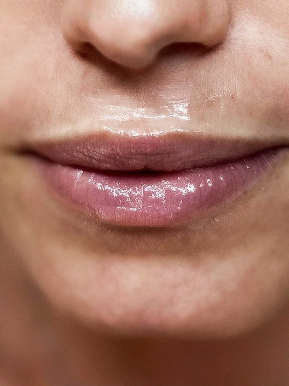 Filler labbra prima