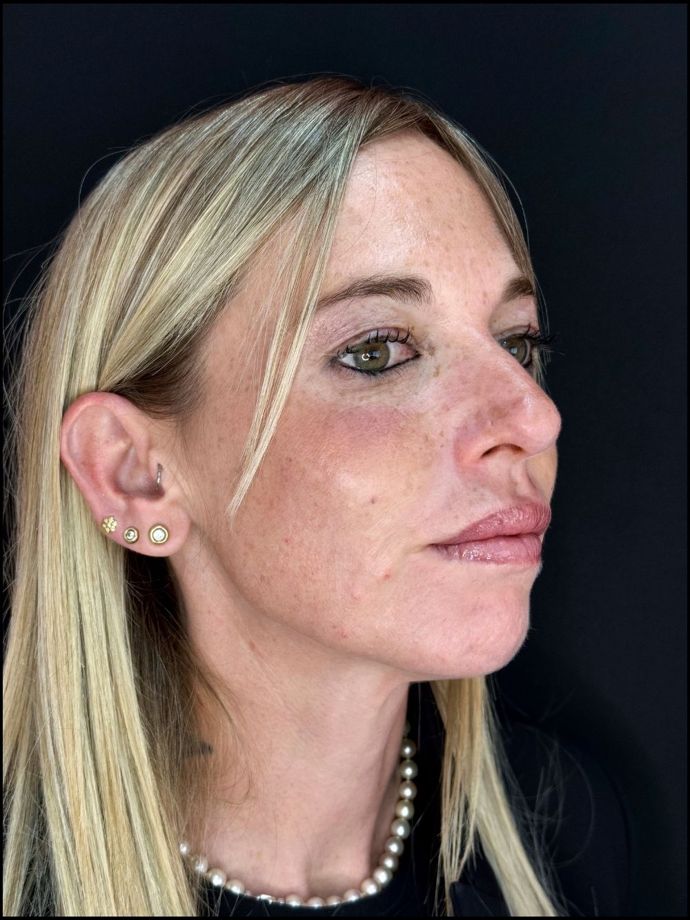 Full face dopo