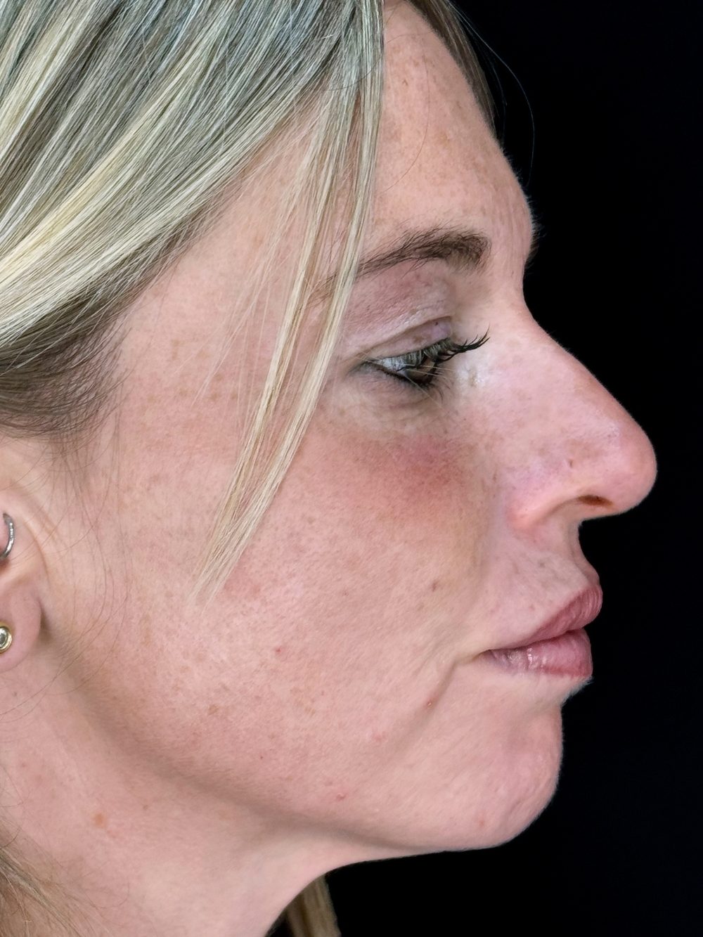 Full face dopo